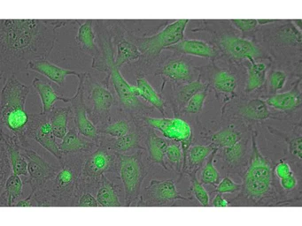 Anti-Lactate Dehydrogenase antibody used in Immunocytochemistry/ Immunofluorescence (ICC/IF). GTX22101