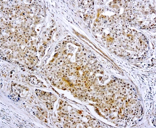 Anti-MMP9 antibody used in IHC (Paraffin sections) (IHC-P). GTX22167