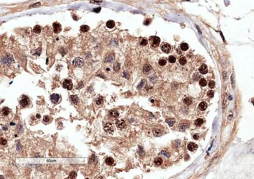 Anti-RACGAP1 antibody used in IHC (Paraffin sections) (IHC-P). GTX22270