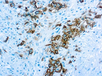 Anti-Mesothelioma antibody [HBME-1] used in IHC (Paraffin sections) (IHC-P). GTX22383