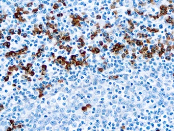Rabbit Anti-Human IgG antibody. GTX22410