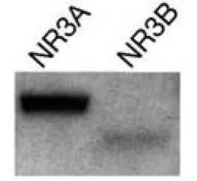 Anti-NMDAR3A + NMDAR3B antibody [K35/40] used in Western Blot (WB). GTX22639