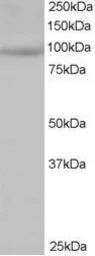 Anti-MAP4K1 antibody, N-term used in Western Blot (WB). GTX22646