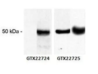 Anti-CaMKII alpha (phospho Thr286) antibody [22B1] used in Western Blot (WB). GTX22724