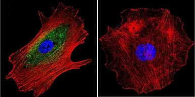 Anti-alpha Adaptin antibody [AP6] used in Immunocytochemistry/ Immunofluorescence (ICC/IF). GTX22730
