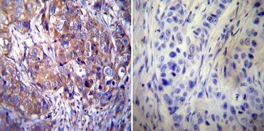 Anti-Clathrin Heavy chain antibody [X22] used in IHC (Paraffin sections) (IHC-P). GTX22731
