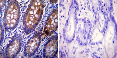 Anti-Clathrin Heavy chain antibody [X22] used in IHC (Paraffin sections) (IHC-P). GTX22731
