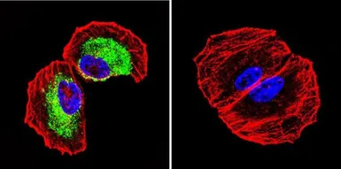Anti-Clathrin Heavy chain antibody [X22] used in Immunocytochemistry/ Immunofluorescence (ICC/IF). GTX22731