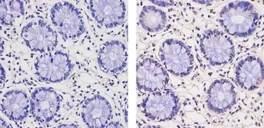 Anti-Thyroid Hormone Receptor beta antibody [J52] used in IHC (Paraffin sections) (IHC-P). GTX22744