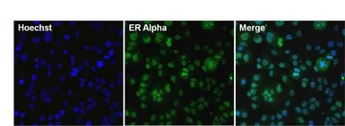 Anti-Estrogen Receptor alpha antibody [33] used in Immunocytochemistry/ Immunofluorescence (ICC/IF). GTX22746