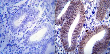Anti-Progesterone Receptor antibody [Alpha PR6] used in IHC (Paraffin sections) (IHC-P). GTX22765