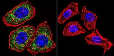 Anti-Glucocorticoid Receptor antibody [BuGR2] used in Immunocytochemistry/ Immunofluorescence (ICC/IF). GTX22768