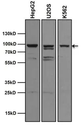 Anti-AHR antibody [RPT1] used in Western Blot (WB). GTX22770