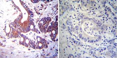 Anti-Mineralocorticoid Receptor antibody [H10E4C9F] used in IHC (Paraffin sections) (IHC-P). GTX22774