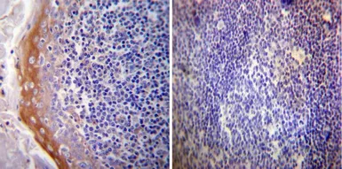 Anti-Mineralocorticoid Receptor antibody [H10E4C9F] used in IHC (Paraffin sections) (IHC-P). GTX22774