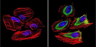 Anti-GRK1 antibody [G8] used in Immunocytochemistry/ Immunofluorescence (ICC/IF). GTX22775