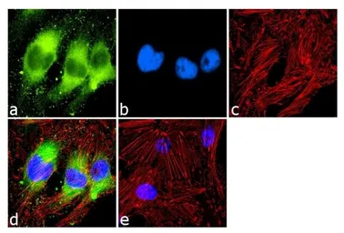 Anti-PPAR alpha antibody [3B6/PPAR] used in Immunocytochemistry/ Immunofluorescence (ICC/IF). GTX22779
