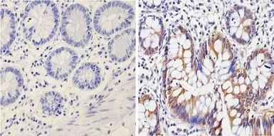 Anti-Galectin 3 antibody [A3A12] used in IHC (Paraffin sections) (IHC-P). GTX22785