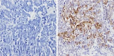 Anti-Galectin 3 antibody [A3A12] used in IHC (Paraffin sections) (IHC-P). GTX22785