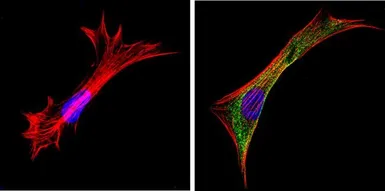 Anti-Galectin 3 antibody [A3A12] used in Immunocytochemistry/ Immunofluorescence (ICC/IF). GTX22785