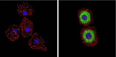 Anti-Endothelin 1 antibody [TR.ET.48.5] used in Immunocytochemistry/ Immunofluorescence (ICC/IF). GTX22786