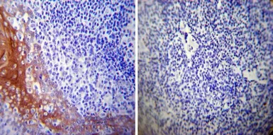 Anti-HSP27 antibody [G3.1] used in IHC (Paraffin sections) (IHC-P). GTX22790
