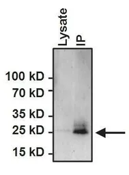 Anti-HSP27 antibody [G3.1] used in Immunoprecipitation (IP). GTX22790