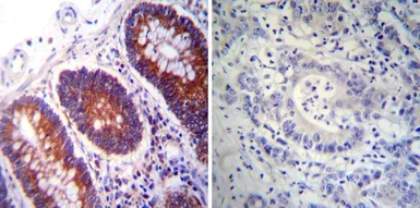 Anti-PDI antibody [RL90] used in IHC (Paraffin sections) (IHC-P). GTX22792