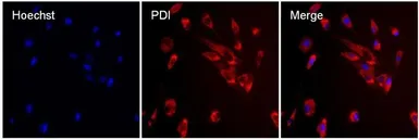 Anti-PDI antibody [RL90] used in Immunocytochemistry/ Immunofluorescence (ICC/IF). GTX22792