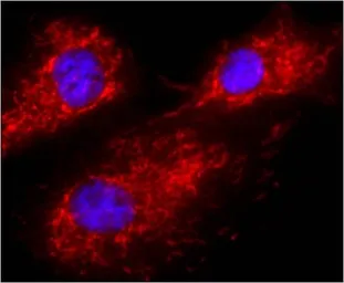 Anti-Calnexin antibody [AF18] used in Immunocytochemistry/ Immunofluorescence (ICC/IF). GTX22798