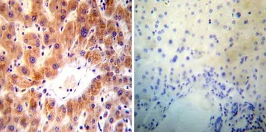 Anti-ARF1/ARF3/ARF5/ARF6 antibody [1D9] used in IHC (Paraffin sections) (IHC-P). GTX22806