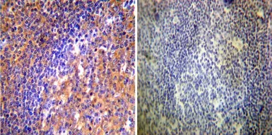 Anti-ARF1/ARF3/ARF5/ARF6 antibody [1D9] used in IHC (Paraffin sections) (IHC-P). GTX22806