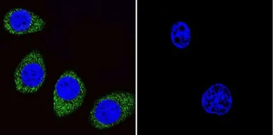 Anti-ARF1/ARF3/ARF5/ARF6 antibody [1D9] used in Immunocytochemistry/ Immunofluorescence (ICC/IF). GTX22806