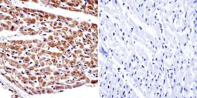 Anti-alpha Adaptin antibody [AC1-M11] used in IHC (Paraffin sections) (IHC-P). GTX22807