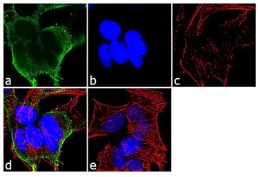 Anti-alpha Adaptin antibody [AC1-M11] used in Immunocytochemistry/ Immunofluorescence (ICC/IF). GTX22807