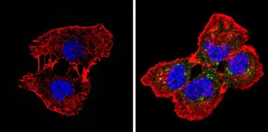Anti-Spectrin beta 1 antibody [4C3] used in Immunocytochemistry/ Immunofluorescence (ICC/IF). GTX22808