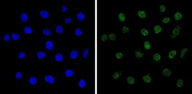 Anti-MECP2 antibody used in Immunocytochemistry/ Immunofluorescence (ICC/IF). GTX22828