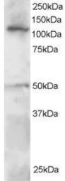 Anti-HLTF antibody used in Western Blot (WB). GTX22835
