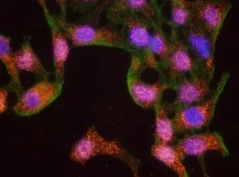 Anti-Chk1 antibody used in Proximity ligation assay (PLA). GTX22845