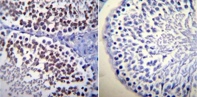 Anti-Calmodulin antibody [2D1] used in IHC (Paraffin sections) (IHC-P). GTX22860