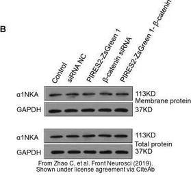 Anti-Sodium Potassium ATPase antibody [9-A5] used in Western Blot (WB). GTX22867