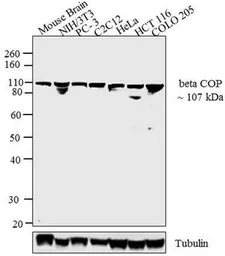 Anti-COPB antibody used in Western Blot (WB). GTX22899