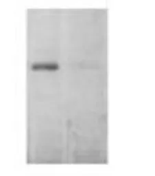 Anti-EEA1 antibody used in Western Blot (WB). GTX22900
