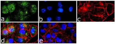 Anti-Caveolin 1 antibody used in Immunocytochemistry/ Immunofluorescence (ICC/IF). GTX22910