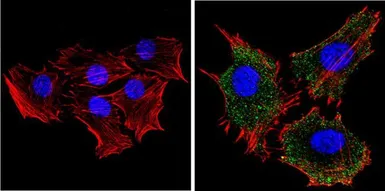 Anti-RASA1 antibody [B4F8] used in Immunocytochemistry/ Immunofluorescence (ICC/IF). GTX22922