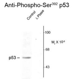 Anti-p53 (phospho Ser392) antibody used in Western Blot (WB). GTX23257