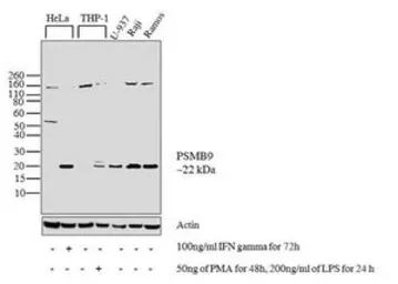 Anti-LMP2 antibody used in Western Blot (WB). GTX23328