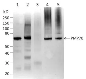 Anti-PMP70 antibody used in Western Blot (WB). GTX23421