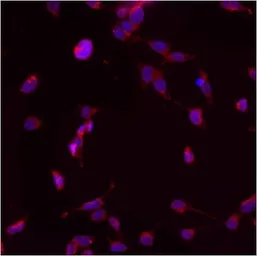 Anti-PMP70 antibody used in Immunocytochemistry/ Immunofluorescence (ICC/IF). GTX23421