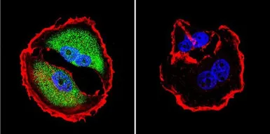 Anti-NFAT5 antibody used in Immunocytochemistry/ Immunofluorescence (ICC/IF). GTX23446